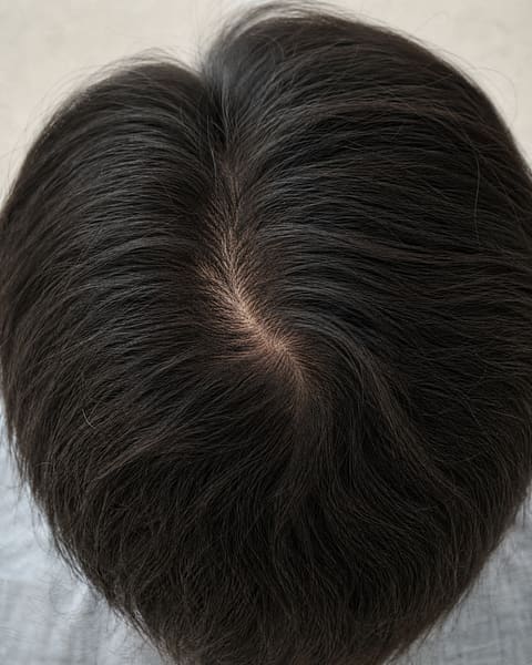 The same crown photographed six weeks later